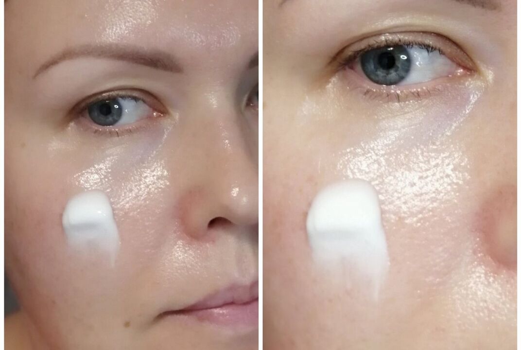 Applying Inno Gialuron cream