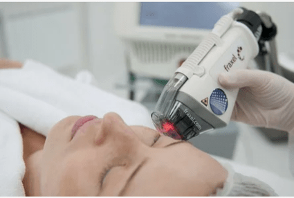 Laser rejuvenation