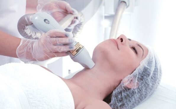 Fractional laser skin resurfacing