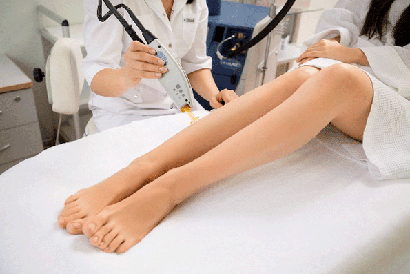 epilation