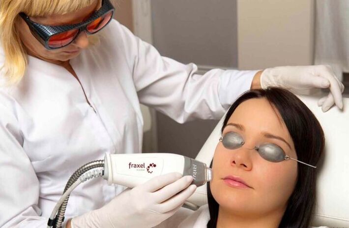 Laser Skin Rejuvenation