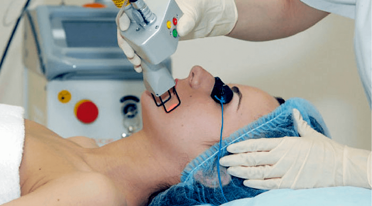 Laser skin rejuvenation procedures